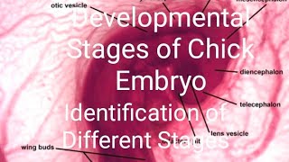 Developmental Stages Of Chick Embryo Study Of 24 Hrs To 96 Hrs Stages Wm Slidesbszoology