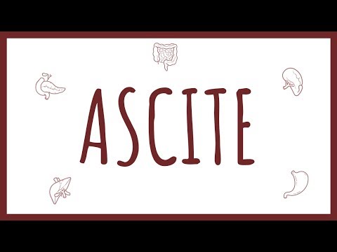 Vidéo: Ascite: Symptômes, Traitement, Causes, Stades, Pronostic