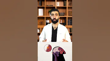 اسباب الصداع التهاب الجيوب الأنفية 