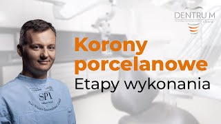 Korony porcelanowe, etapy wykonania koron przez technika protetyka