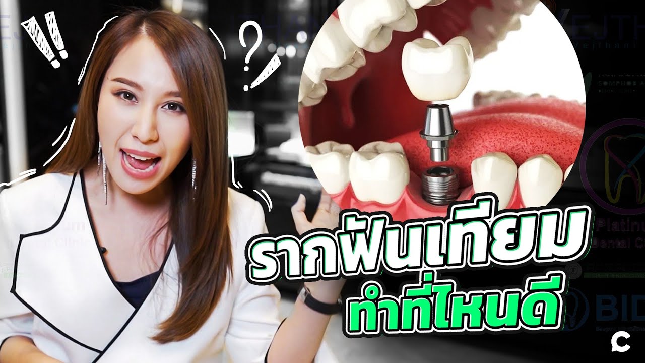 จะทำรากฟันเทียมต้องไปทำที่ไหน? | Straumann