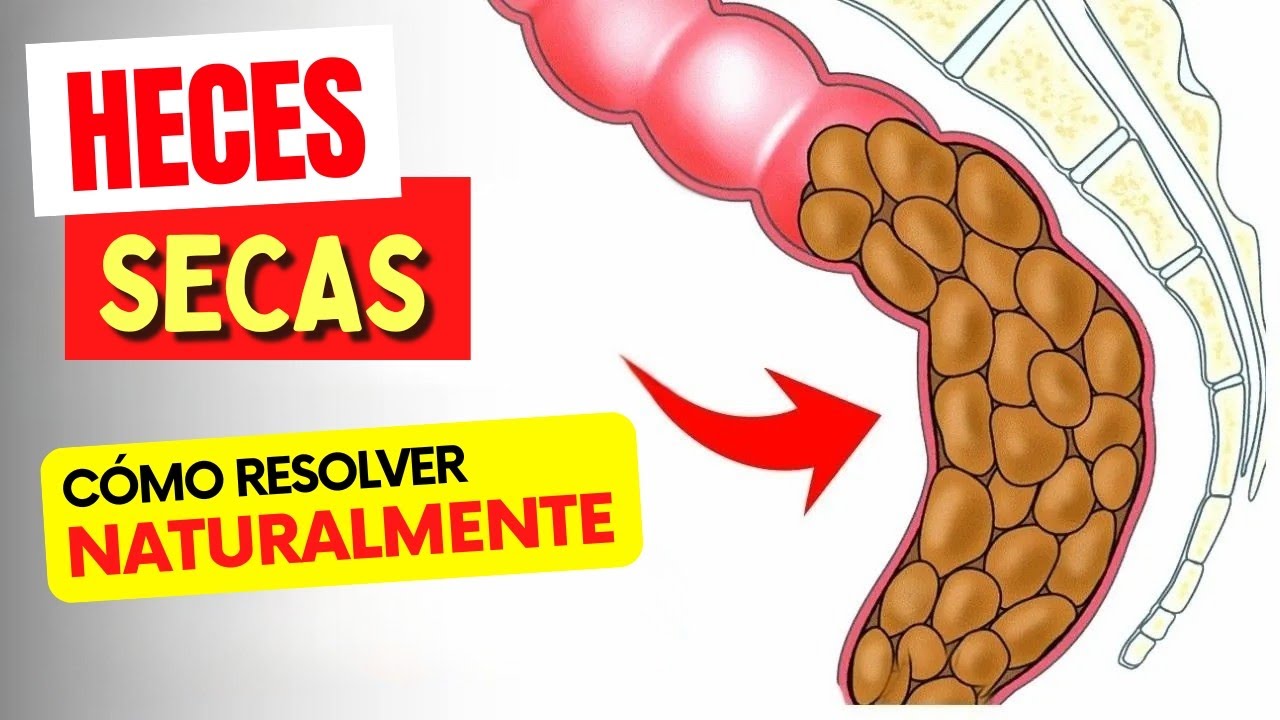 HECES SECAS y Estreñimiento - ¡Cómo Resolver NATURALMENTE!