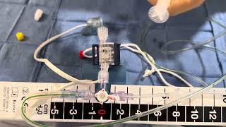 Setting Up Codman EVD System