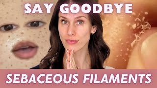 How To Get Rid Of Sebaceous Filaments