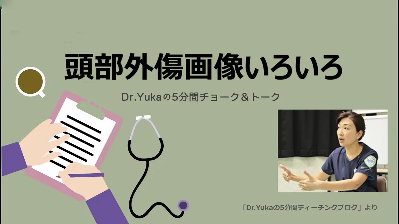 頭部外傷画像いろいろ