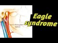 Eagle syndrome || orofacial syndrome || Oral pathology ||oralmedicine ||neetmds|| BDS