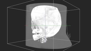 2D Texture Based-Volume Rendering