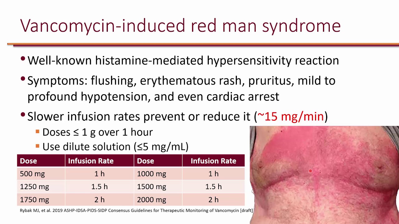 PK-PD Vancomycin LO 2 - YouTube