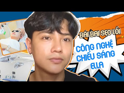 Video Trị Sẹo lồi với công nghệ chiếu sáng Ella - youtube
