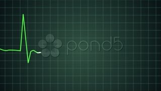 Green Ekg Heart Monitor Goes Flatline Hd Pal. Stock Footage