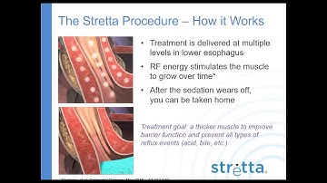 Stretta Patient Webinar 2017 Dr Reiss