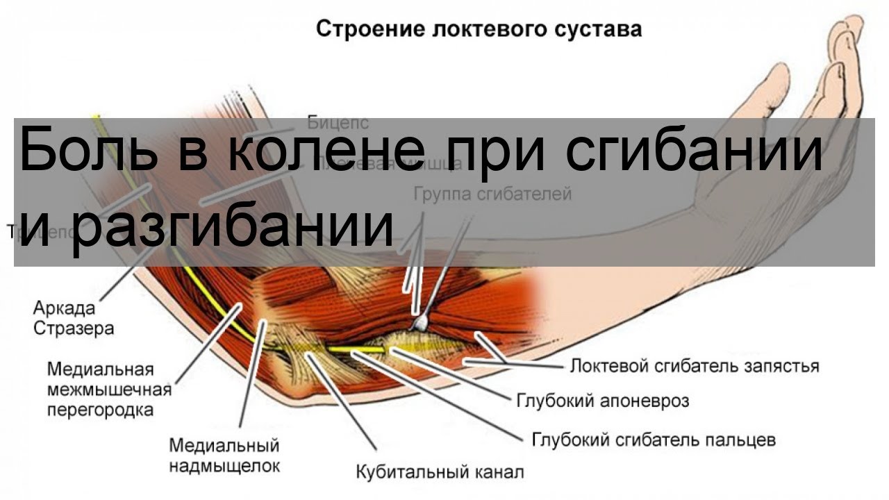 Болит при сгибании и разгибании ноги. Боли в коленном суставе при сгибании и разгибании. Болит колено при сгибании. Боль в колене при сгибании и разгибании. Боли при згибании и разгибание в колене.