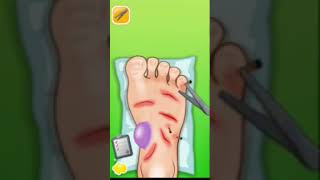 Crazy Foot Doctor gameplay screenshot 1