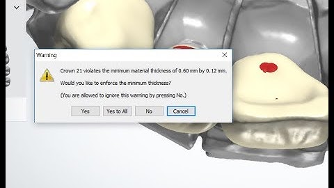 enforce minimum thickness yes or no in 3shape dental designer