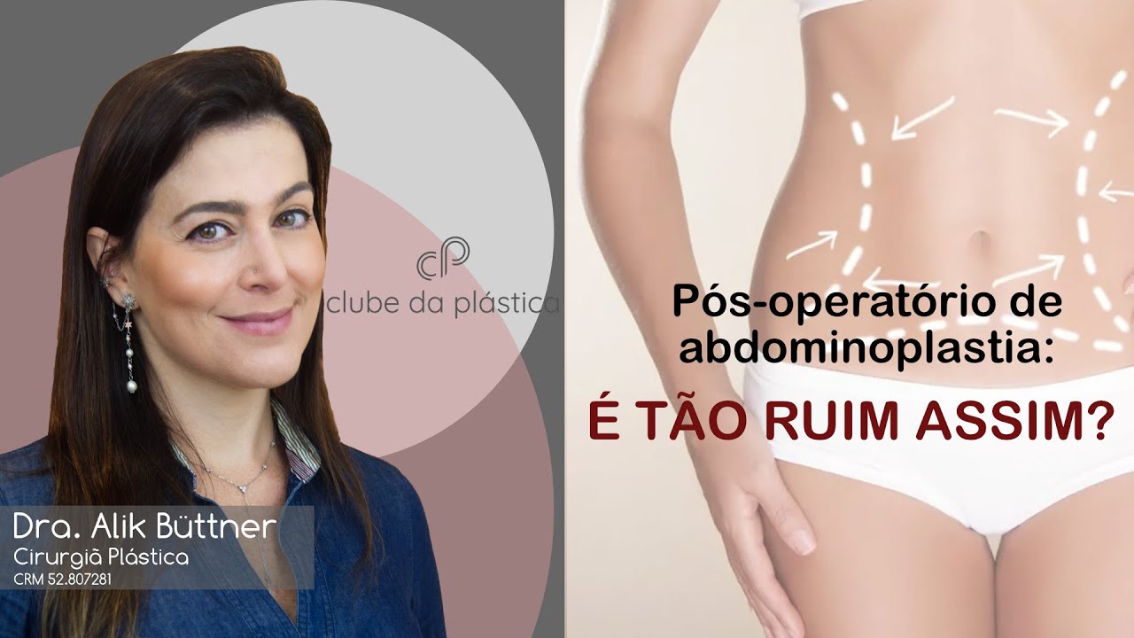 Clube da Plástica: Pós-operatório de abdominoplastia - é tão ruim assim?