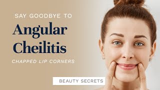 How to Get Rid of Angular Cheilitis (Chapped Lip Corners)