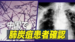 中国で肺炭疽患者１人確認 2011年以降初めて