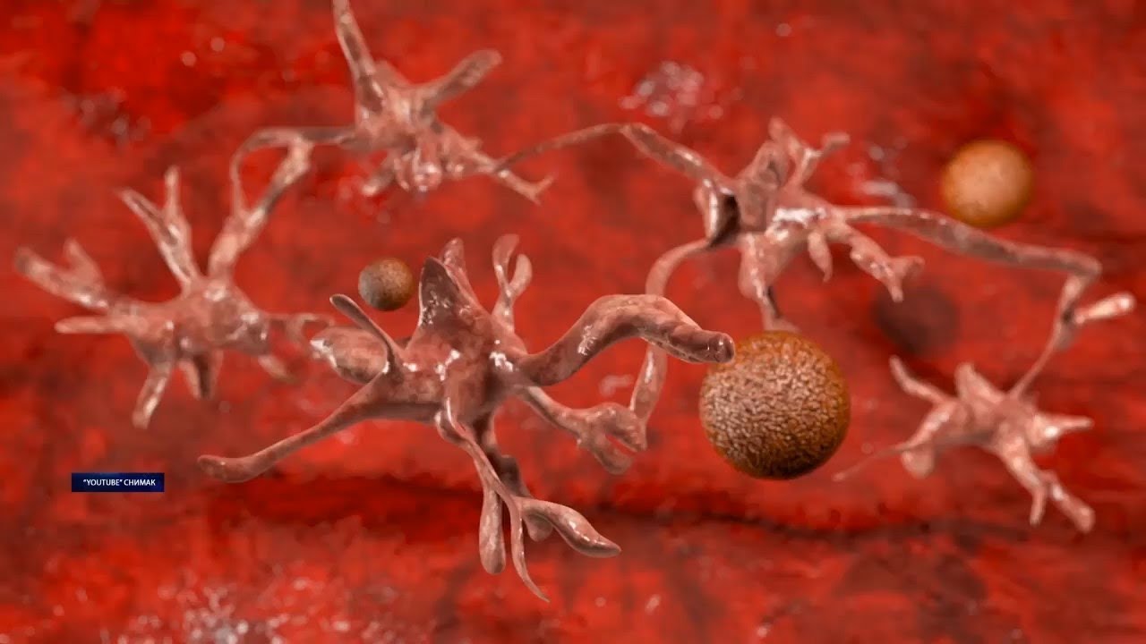 04.02.2019.SVETSKI DAN BORBE PROTIV RAKA milanovac gornji hotel