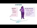 Bulimia nervosa - causes, symptoms, diagnosis, treatment & pathology