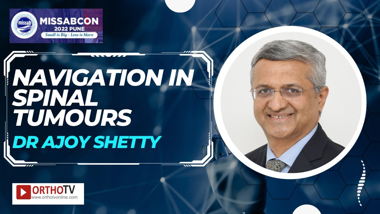 Navigation in Spinal Tumours - Dr Ajoy Shetty - YouTube