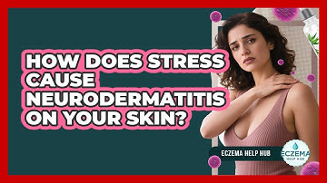 How Does Stress Cause Neurodermatitis On Your Skin? - Eczema Help Hub