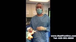 Dr. Brandon Nelson Performs a Neuroma Excision