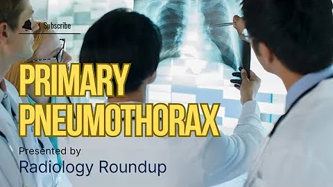 Managing Primary Spontaneous Pneumothorax: Treatment Options Explained