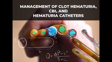 Management of Clot Urinary Retention, CBI, and hematuria catheters