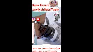 Beyi̇n Tümörü Ameli̇yati Nasıl Yapılır? Prof. Dr. Alper Karaoğlan