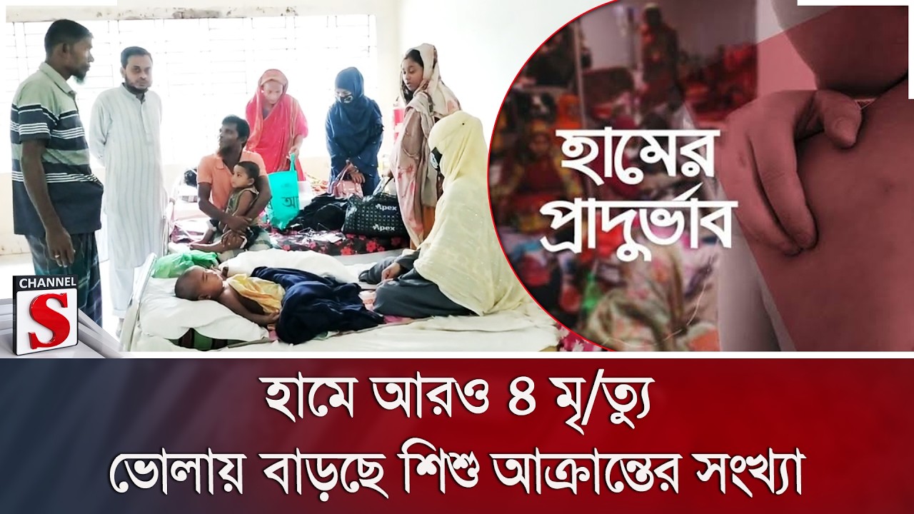 হামে আরও ৪ মৃ/ত্যু; ভোলায় বাড়ছে শিশু আক্রান্তের সংখ্যা | Measles | Dengue | Channel S News