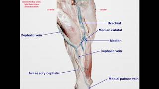 LA Vessels of Thoracic Limb