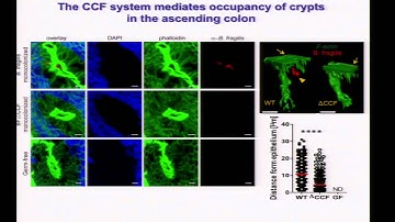 Bacterial Colonization Factors ... Specificity & Stability of Gut Microbiota - Sarkis Mazmanian