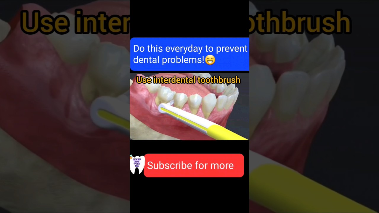 Do this everyday to prevent dental problems