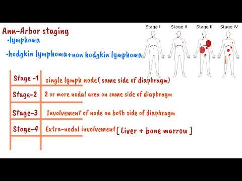 Ann Arbor staging system for Lymphoma | Oncology 