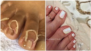 Most Satisfying Pedicure Transformation 😱 best nail polish for toes 2023