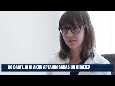 Video: Pie aknu izliekuma?