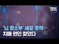 미지의 병 치매, 과산화수소를 제거하면 중단시킬 수 있다.