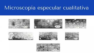 Microscopía Especular y Confocal - Dr. Joaquín A. Sosa Lockward