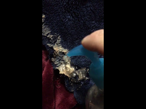 How to remove silly putty from fabric
