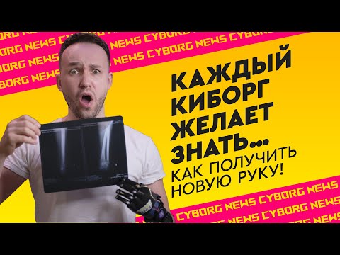 Как получить протез ? | Как оформить ИНВАЛИДНОСТЬ, ИПРА и пройти комиссию МСЭ