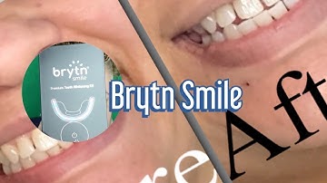 Trying Brytn Smile Teeth Whitener