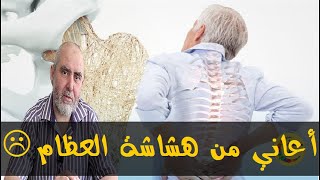 المعاناة مع هشاشة العظام وطرق العلاج بمواد طبيعية  - الدكتور كريم العابد العلوي -