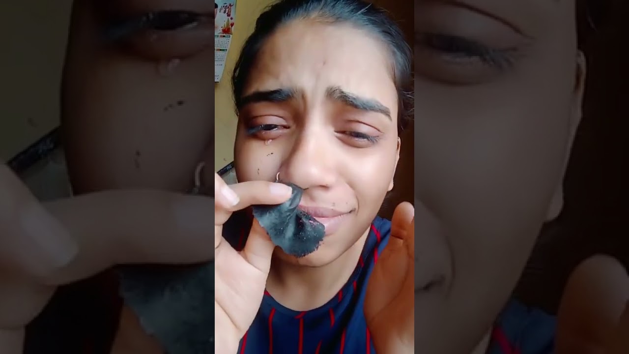 removing painful charcoal mask cream || removing blackheads💯👆🏻 