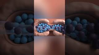Nonhodgkins Lymphoma  3d Medical Animation