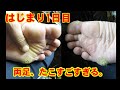 はじまり1日目：両足、たこすごすぎる。help me