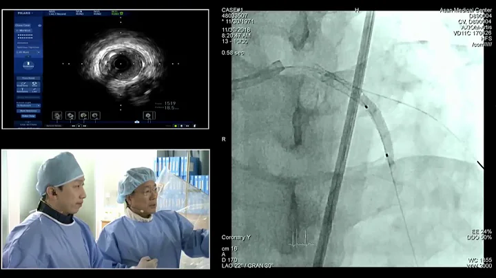 [COMPLEX PCI 2018] Opening & Live Case Demonstrati...