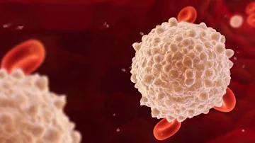 ¿Es alto el recuento de glóbulos blancos en el linfoma?