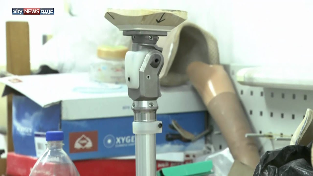 صناعة الأطراف الاصطناعية تزدهر بغزة