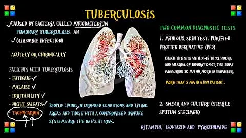 NCLEX Review on Tuberculosis (Important to know for the NCLEX)