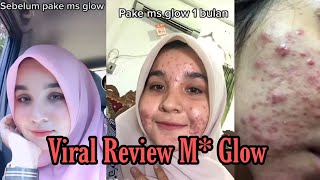 HENTIKAN! 6 Tanda Skincare Gak Cocok di Kulit!